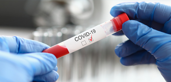 vg-cottbus-nur-labordiagnostik-mit-pcr-test-kann-grundlage-fuer-nachweis-der-genesung-von-corona-sein